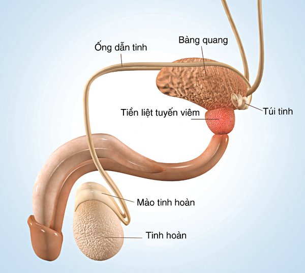 Cách chữa viêm tiền liệt tuyến ở nam giới hiệu quả: Giải pháp tối ưu cho sức khỏe nam giới